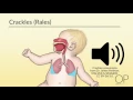 Respiratory Assessment by B Leary L DelSignore OPENPediatrics