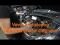 Download Lagu Vevor Endoscoop, Erg handig voor een snelle diagnose.