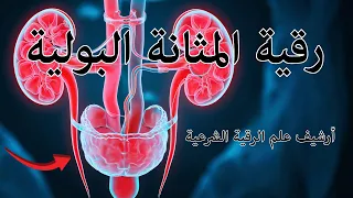 رقية المثانة 