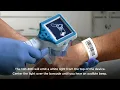 NPi-300 Pupillometer Pupil Exam