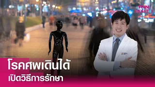 แพทย์วินิจฉัยโรคศพเดินได้อย่างไร