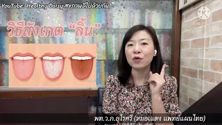ลิ้นที่บ่งบอกถึงสุขภาพดีมีลักษณะอย่างไร