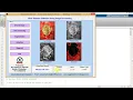 Ulcer Detection Using Image Processing Matlab Project Code