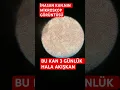 HALA AKIŞKAN KAN MİKROSKOP HİVOTUM EKLOBİN KOLİNAYA BOLİFONGİÇ WARTHİLANT