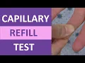 Capillary Refill Time Test Normal vs Abnormal - Nursing Clinical Skills