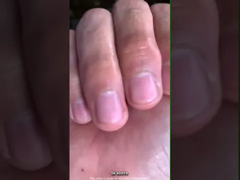little fish story