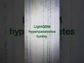 LightGBM hyperparameters