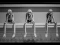 Human Anatomy Ch 8 Appendicular Skeleton UE P1