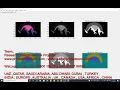 Image segmentation using particle swarm optimization and simulated annealing PSO SA Annealing