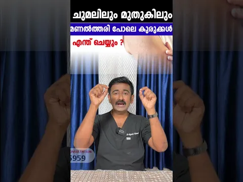 ചുമലിലും മുതുകിലും മണൽത്തരി പോലെ കുരുക്കൾ .. എന്ത് ചെയ്യും ?