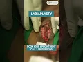 Download Lagu Labiaplasty Surgery, Vagina Tighten, Plastic Surgery at Elegance Clinic in Vesu, Surat