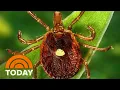 How A Bite From A Lone Star Tick Can Trigger Severe Allergy To Meat