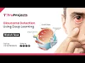 Glaucoma Detection using Deep Learning