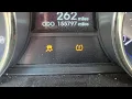 Hyundai Sonata random ABS Traction Control lights loss of power fix