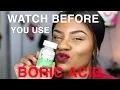 BEWARE WATCH THIS BEFORE USING BORIC ACID FT VEE FRESH