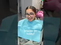 Braces On Today Here s How It s Done
