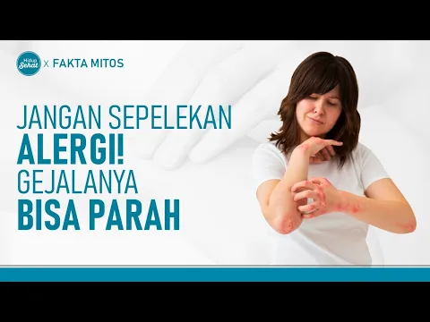 Berbagai Penyebab Alergi dan Cara Mencegahnya