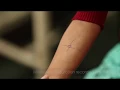 Training Tuberculin skin testing