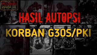 Download SANGAT MENYERAMKAN!!! HASIL AUTOPSI KORB4N PERISTIWA LUBANG BUAYA (G30S/PKI)!!! MP3