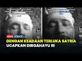 Download Lagu Satria Kumbara Terluka Usai Dikepung Drone dan Dihujani Mortir Ukraina di Medan Tempur