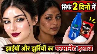 चेहरे की झाइयां और झुर्रियां मिटाने की घरेलू उपाय/How To Remove Pigmentation & Wrinkles 