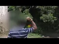 A short story of a person with both sex organs Hermaphroditism