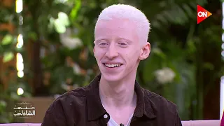 مفاجأة عن محمد منير بسبب فيلم ضي  دندنها