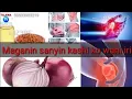 Download Lagu Maganin dukkan sanyin kashi ko gwiwa da yake hana tafiya da amfanin citta ajiki by Dr. Abdulwahab