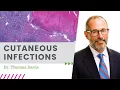 Cutaneous Infections June 2020 Dermpath Happy Hour