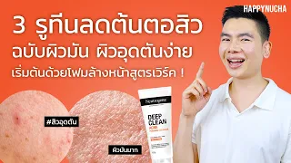 3 รูทีนดูแลสิวจากต้นตอ สิวอุดตัน ผิวมัน | Neutrogena Deep Clean Acne Foaming Cleanser