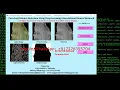 Python Code On Corn Leaf Disease Detection Using Neural Network CNN Corn Leaf Disease Analysis