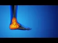 Pain in the big toe stock footage stock Cinefootage