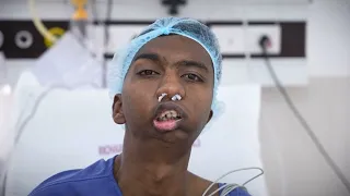He Couldn’t Open His Mouth | Jaw Joint Replacement & Jaw Surgery