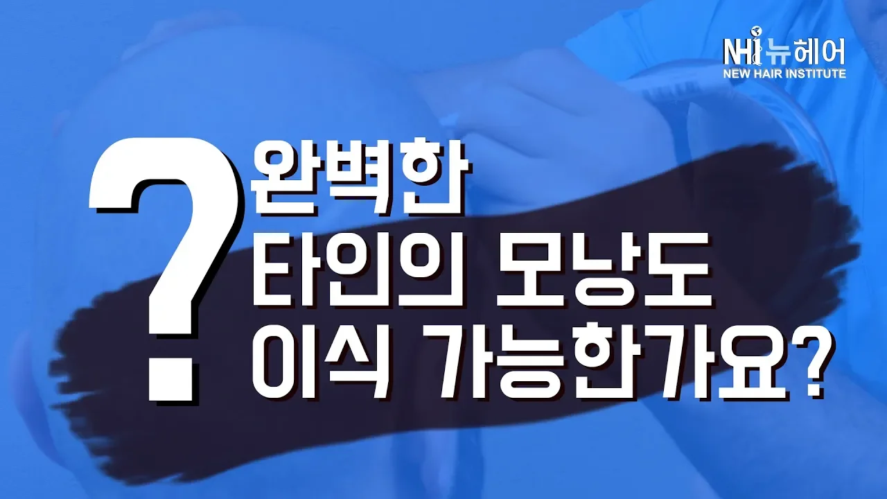 다른 사람의 모낭으로 내 머리에 이식 가능 한가요? - 뉴헤어 I 모발이식 I 탈모QnA I