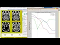 Matlab code for Brain Tumor Detection using Convolutional Neural Network