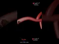Download Lagu Ischemic Stroke By A Blood Clot | CVA | Cerebral Vascular Accident | Animation