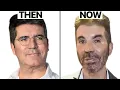 Simon Cowell NEW FACE Plastic Surgery Analysis