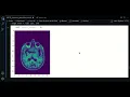 2 3 - Padding SimpleITK