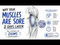 Why Your Muscles Are Sore 2 Days Later The Science of DOMS Explained