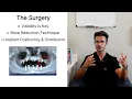 Full-Arch Implants My All-on-X Protocol 2026