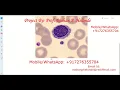 Blood Cell Classification Using CNN Python Source Code Blood Cell Detection Using Neural Network