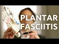 PLANTAR FASCIITIS - About this heel pain the causes how to examine and diagnose