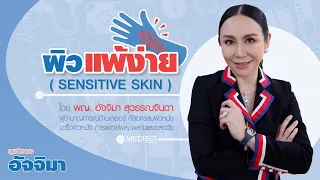 ผิวแพ้ง่ายคืออะไร และมีอาการอย่างไรบ้าง