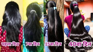गंजे होने से पहले ये लगालो, बाल रोज़ाना झड़ते/टूटते है, रात मे सोने से पहले लगालो,1 Month Long Hair 