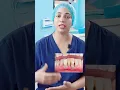 Download Lagu Pyorrhea #dentalcare #viral #dentaltips #comments  #dentistryworld #pyorrhea #shorts #viralshort