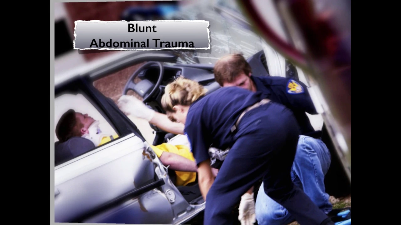 How to Perform the eFAST or FAST Scan (Extended Focused Assessment with Sonography for Trauma)