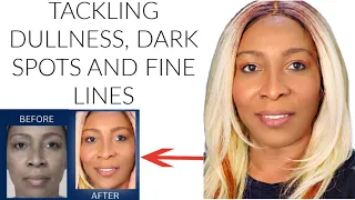 Transform Your Skin Live — Tackling Dullness, Dark Spots, and Fine Lines Together