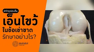 ทำไมเอ็นไขว้หน้าถึงเปราะบางและเสี่ยงต่อการฉีกขาดเมื่อเล่นกีฬา