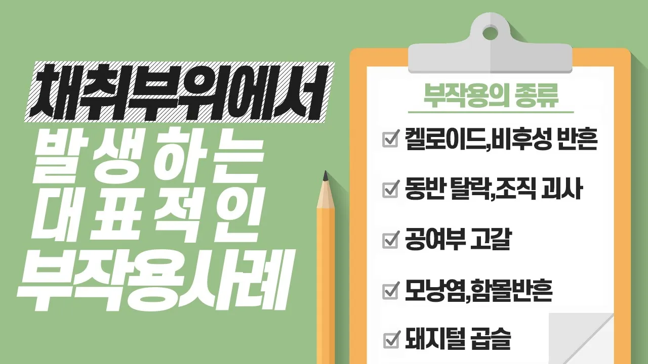 모발이식수술을 계획중인 당신이 꼭 봐야할 영상!📽