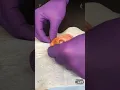 Ear Lobe Piercing